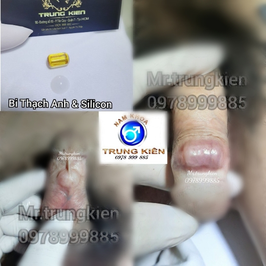 Hình ảnh gắn bi cậu nhỏ
